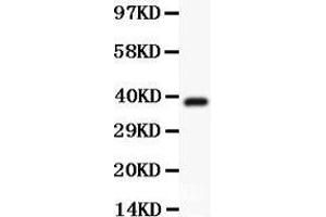 Anti-Hamartin Picoband antibody,  All lanes: Anti Hamartin  at 0. (TSC1 抗体  (AA 686-884))