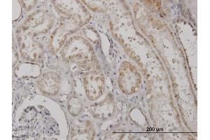 Immunostaining (ISt) image for anti-ClpP Caseinolytic Peptidase, ATP-Dependent, Proteolytic Subunit Homolog (E. Coli) (CLPP) (AA 178-277) antibody (ABIN563560)