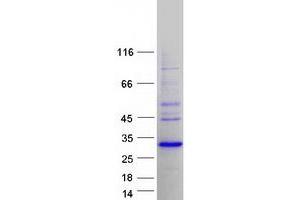 Validation with Western Blot (SSX2 Protein (Myc-DYKDDDDK Tag))