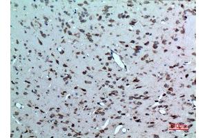 Immunohistochemistry (IHC) analysis of paraffin-embedded Rat Brain, antibody was diluted at 1:100.