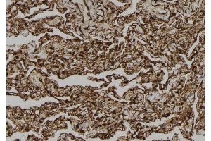 ABIN6278874 at 1/100 staining Human lung tissue by IHC-P. (CARD18 抗体  (C-Term))