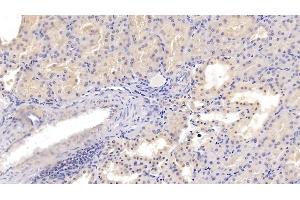 Detection of PDGFB in Porcine Kidney Tissue using Polyclonal Antibody to Platelet Derived Growth Factor Subunit B (PDGFB) (PDGFB 抗体  (AA 84-199))