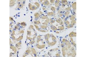 Immunohistochemistry of paraffin-embedded Human stomach using PSPH Polyclonal Antibody at dilution of 1:100 (40x lens). (PSPH 抗体)