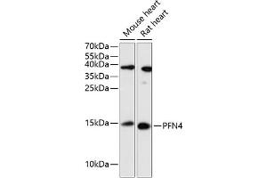 Western blot analysis of extracts of various cell lines, using PFN4 antibody (ABIN6129663, ABIN6145495, ABIN6145496 and ABIN6217780) at 1:3000 dilution. (Profilin 4 抗体  (AA 1-129))