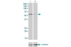 Western blot analysis of STK38 over-expressed 293 cell line, cotransfected with STK38 Validated Chimera RNAi (Lane 2) or non-transfected control (Lane 1). (STK38 抗体  (AA 365-465))