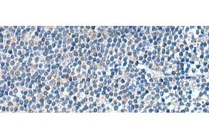 Immunohistochemistry of paraffin-embedded Human tonsil tissue using KIF2A Polyclonal Antibody at dilution of 1:65(x200) (KIF2A 抗体)