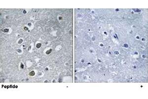 Immunohistochemistry analysis of paraffin-embedded human brain tissue using MARCH4 polyclonal antibody . (MARCH4 抗体)