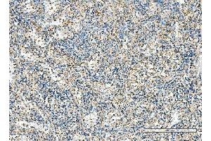 IHC analysis of IMPDH1 using anti-IMPDH1 antibody (ABIN7599864).