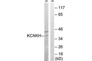 Western Blotting (WB) image for anti-Potassium Channel, Subfamily K, Member 17 (KCNK17) (AA 271-320) antibody (ABIN2890517) (KCNK17 抗体  (AA 271-320))