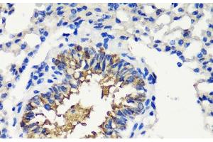 Immunohistochemistry of paraffin-embedded Mouse lung using FKBP1A Polyclonal Antibody at dilution of 1:200 (40x lens). (FKBP1A 抗体)