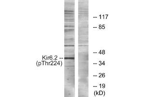 Western blot analysis of extracts from HeLa cells, using Kir6. (KCNJ11 抗体  (pThr224))