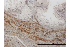 Immunoperoxidase of monoclonal antibody to NKIRAS1 on formalin-fixed paraffin-embedded human prostate. (NKIRAS1 抗体  (AA 1-100))