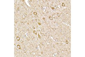 Immunohistochemistry (IHC) image for anti-Sterol Regulatory Element Binding Transcription Factor 2 (SREBF2) (AA 1-220) antibody (ABIN6148430)
