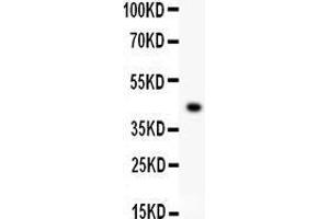 Anti- EDA antibody, Western blotting All lanes: Anti EDA  at 0. (Ectodysplasin A 抗体  (AA 30-391))