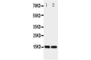Anti-Fatty Acid Binding Protein 5 antibody, Western blottingAll lanes: Anti Fatty Acid Binding Protein 5  at 0. (FABP5 抗体  (N-Term))