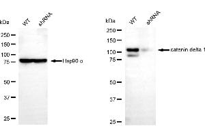 Western blotting analysis using catenin delta 1 antibody (ABIN7797933).