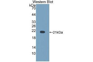 Detection of Recombinant CD164, Rat using Polyclonal Antibody to Cluster Of Differentiation 164 (CD164) (CD164 抗体  (AA 24-160))