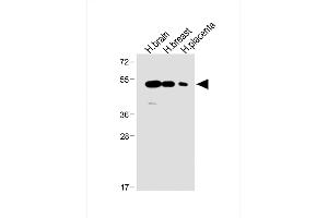 All lanes : Anti-ENT1 Antibody (C-term) at 1:1000 dilution Lane 1: Human brain lysate Lane 2: Human breast lysate Lane 3: Human placenta lysate Lysates/proteins at 20 μg per lane. (SLC29A1 抗体  (C-Term))