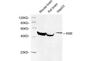 Western blot analysis of cell and tissue lysates using 1 µg/mL Rabbit Anti-NSE Polyclonal Antibody (ABIN398879) The signal was developed with IRDyeTM 800 Conjugated Goat Anti-Rabbit IgG. (ENO2/NSE 抗体  (N-Term))