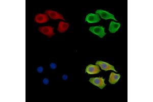 ABIN7095965 and ABIN7100027 staining Hela cells by IF/ICC. (SNX12 抗体)