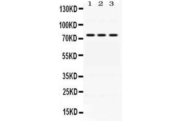 ACSL1 抗体  (AA 604-698)