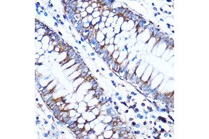 Immunohistochemistry of paraffin-embedded Human colon using CTGF Rabbit pAb (ABIN6127717, ABIN6139188, ABIN6139191 and ABIN6215222) at dilution of 1:100 (40x lens). (CTGF 抗体  (AA 27-349))