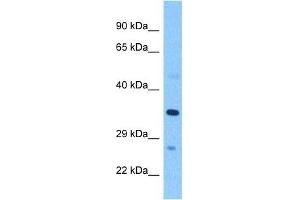 Host:  Rabbit  Target Name:  PSG2  Sample Tissue:  Human Breast Tumor  Antibody Dilution:  1ug/ml (PSG2 抗体)