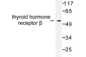 Image no. 1 for anti-Thyroid Hormone Receptor, beta (THRB) antibody (ABIN271853) (THRB 抗体)