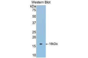 Western Blotting (WB) image for anti-serpin Peptidase Inhibitor, Clade A (Alpha-1 Antiproteinase, Antitrypsin), Member 6 (SERPINA6) (AA 268-391) antibody (ABIN1858272) (SERPINA6 抗体  (AA 268-391))