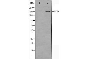 Western blot analysis on HeLa cell lysate using RON Antibody. (MST1R 抗体  (C-Term))