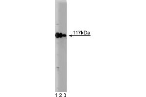 Western Blotting (WB) image for anti-Rabaptin, RAB GTPase Binding Effector Protein 1 (RABEP1) (AA 247-417) antibody (ABIN968104) (RABEP1 抗体  (AA 247-417))