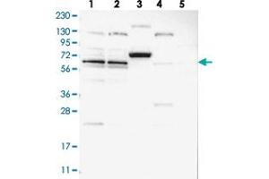 Western blot analysis of Lane 1: RT-4, Lane 2: U-251 MG, Lane 3: Human Plasma, Lane 4: Liver, Lane 5: Tonsil with ZNF324B polyclonal antibody  at 1:250-1:500 dilution. (ZNF324B 抗体)