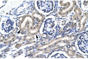 Human kidney; TRAFD1 antibody - C-terminal region in Human kidney cells using Immunohistochemistry (TRAFD1 抗体  (C-Term))