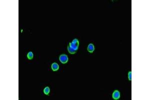 Immunofluorescent analysis of MCF-7 cells using ABIN7145091 at dilution of 1:100 and Alexa Fluor 488-congugated AffiniPure Goat Anti-Rabbit IgG(H+L) (ATG5 抗体  (AA 5-272))