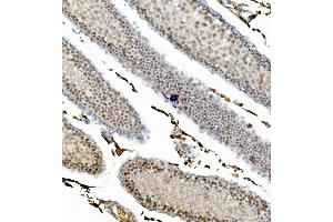 IHC analysis of CCNB1 using anti-CCNB1 antibody (ABIN7599335).