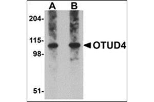 Western blot analysis of OTUD4 in Daudi cell lysate with this product at (A) 0. (OTUD4 抗体  (C-Term))