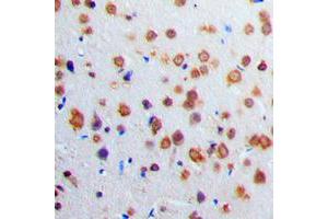 Immunohistochemical analysis of Adenylate Cyclase 1 staining in human brain formalin fixed paraffin embedded tissue section. (ADCY1 抗体  (Center))