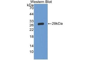 Detection of Recombinant GP5, Human using Polyclonal Antibody to Cluster of Differentiation 42d (CD42d) (GP5 抗体  (AA 17-242))