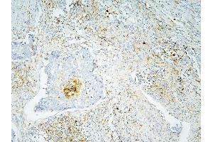 IHC analysis of ANXA3 using anti-ANXA3 antibody (ABIN6719269). (Annexin A3 抗体  (AA 23-323))