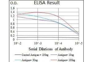 Black line: Control Antigen (100 ng), Purple line: Antigen(10 ng), Blue line: Antigen (50 ng), Red line: Antigen (100 ng), (Surfactant Protein C 抗体  (AA 60-180))