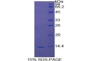 SDS-PAGE analysis of Cow Myostatin Protein. (MSTN 蛋白)