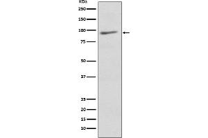 Western Blotting (WB) image for anti-Eukaryotic Translation Initiation Factor 2C3 (EIF2C3) antibody (ABIN7606916)