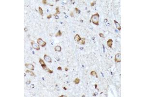 Immunohistochemistry of paraffin-embedded rat brain using BNIP1 Rabbit mAb (ABIN7265867) at dilution of 1:100 (40x lens).