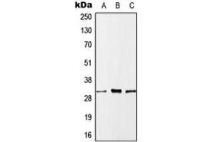 Western blot analysis of MLF1 expression in HeLa (A), SP2/0 (B), H9C2 (C) whole cell lysates. (MLF1 抗体  (Center))