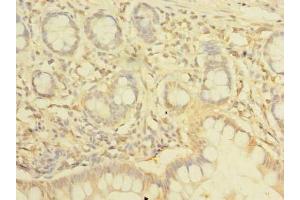 Immunohistochemistry of paraffin-embedded human small intestine tissue using ABIN7161555 at dilution of 1:100 (NHLRC2 抗体  (AA 1-367))