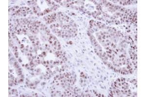 Immunohistochemistry (IHC) image for anti-Nuclear Receptor Subfamily 2, Group C, Member 2 (NR2C2) antibody (ABIN2856042)