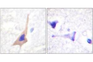 Immunohistochemistry analysis of paraffin-embedded human brain, using Tryptophan Hydroxylase (Phospho-Ser58) Antibody. (Tryptophan Hydroxylase 1 抗体  (pSer58))
