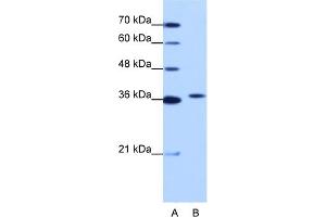 WB Suggested Anti-EXOSC7 Antibody Titration:  1. (EXOSC7 抗体  (N-Term))
