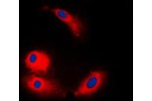 Immunofluorescent analysis of ARMC6 staining in COLO205 cells. (ARMC6 抗体  (C-Term))