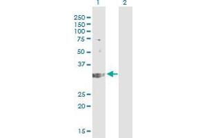 Western Blot analysis of TREX1 expression in transfected 293T cell line by TREX1 monoclonal antibody (M01), clone 2F10. (TREX1 抗体  (AA 1-100))